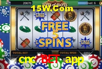 cnc bet app - Customer Support